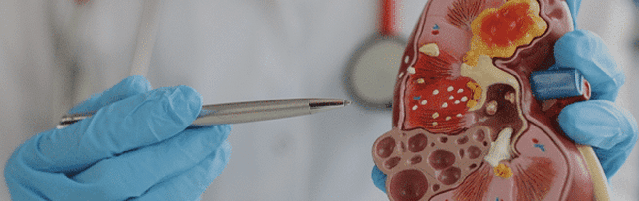 Medical professional explaining human kidney anatomy using a kidney model